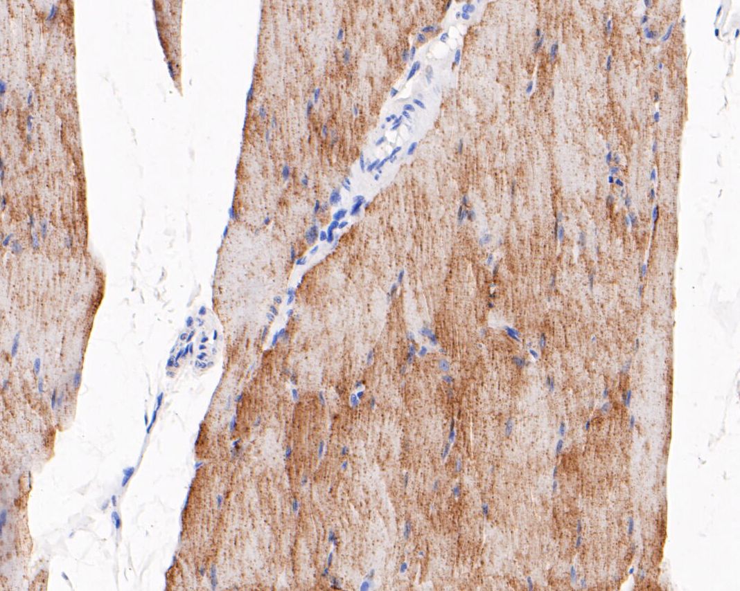 Immunohistochemical analysis of paraffin-embedded rat skeletal muscle tissue using anti-TRIM72 antibody. The section was pre-treated using heat mediated antigen retrieval with Tris-EDTA buffer (pH 8.0-8.4) for 20 minutes.The tissues were blocked in 5% BSA for 30 minutes at room temperature, washed with ddH2O and PBS, and then probed with the primary antibody (EM1901-45, 1/200) for 30 minutes at room temperature. The detection was performed using an HRP conjugated compact polymer system. DAB was used as the chromogen. Tissues were counterstained with hematoxylin and mounted with DPX.