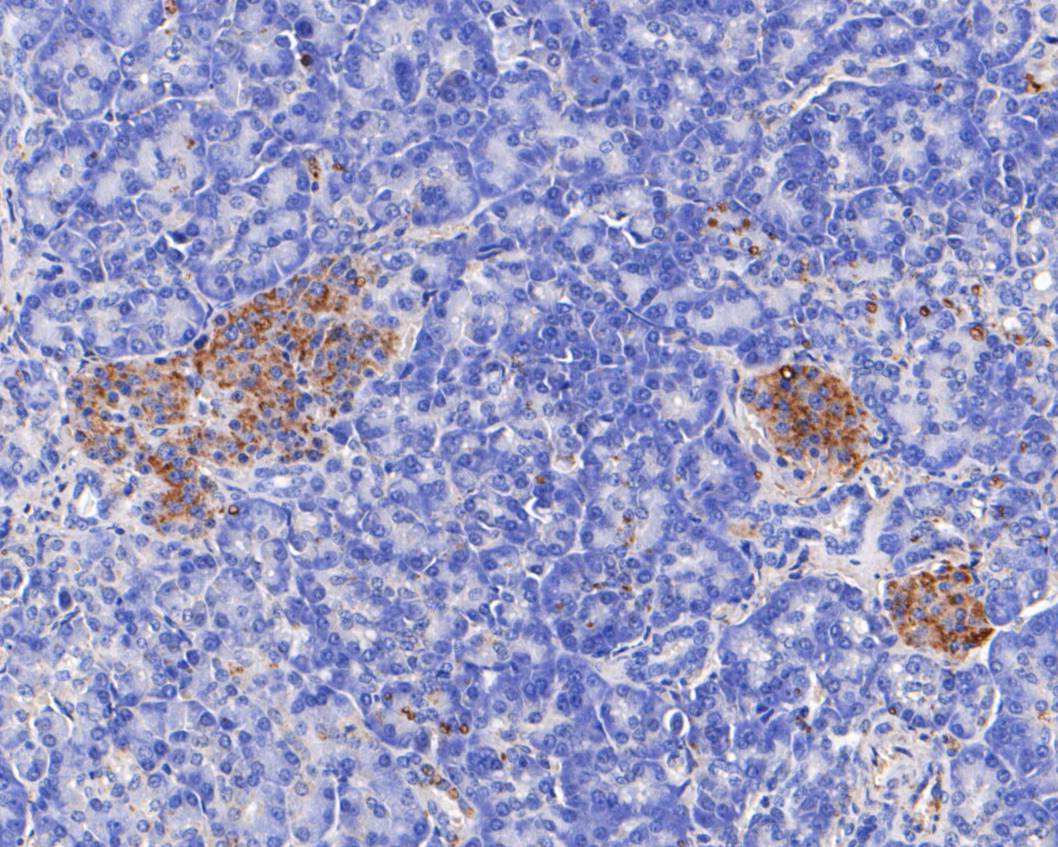 Immunohistochemical analysis of paraffin-embedded human pancreas tissue using anti-TRIM72 antibody. The section was pre-treated using heat mediated antigen retrieval with Tris-EDTA buffer (pH 8.0-8.4) for 20 minutes.The tissues were blocked in 5% BSA for 30 minutes at room temperature, washed with ddH2O and PBS, and then probed with the primary antibody (EM1901-45, 1/200) for 30 minutes at room temperature. The detection was performed using an HRP conjugated compact polymer system. DAB was used as the chromogen. Tissues were counterstained with hematoxylin and mounted with DPX.