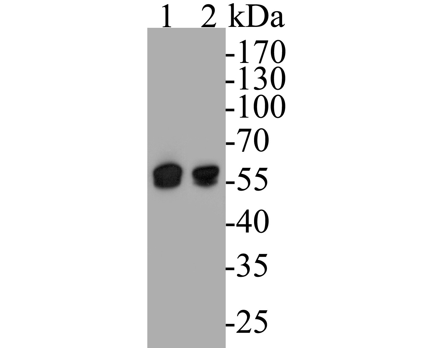 Western blot analysis of DFNA5/GSDME on different lysates. Proteins were transferred to a PVDF membrane and blocked with 5% BSA in PBS for 1 hour at room temperature. The primary antibody (EM1901-48, 1/500) was used in 5% BSA at room temperature for 2 hours. Goat Anti-Mouse IgG - HRP Secondary Antibody (HA1006) at 1:5,000 dilution was used for 1 hour at room temperature.<br />
Positive control: <br />
Lane 1: Hela cell lysate<br />
Lane 2: HepG2 cell lysate