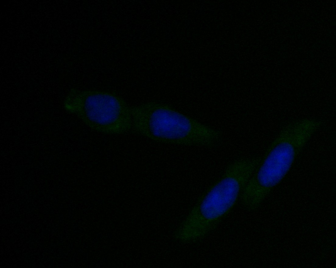 ICC staining of DFNA5/GSDME in SiHa cells (green). Formalin fixed cells were permeabilized with 0.1% Triton X-100 in TBS for 10 minutes at room temperature and blocked with 1% Blocker BSA for 15 minutes at room temperature. Cells were probed with the primary antibody (EM1901-48, 1/50) for 1 hour at room temperature, washed with PBS. Alexa Fluor®488 Goat anti-Mouse IgG was used as the secondary antibody at 1/1,000 dilution. The nuclear counter stain is DAPI (blue).