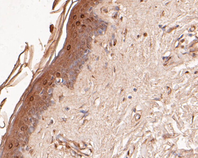 Immunohistochemical analysis of paraffin-embedded rat testis tissue using anti-DFNA5/GSDME antibody. The section was pre-treated using heat mediated antigen retrieval with Tris-EDTA buffer (pH 8.0-8.4) for 20 minutes.The tissues were blocked in 5% BSA for 30 minutes at room temperature, washed with ddH2O and PBS, and then probed with the primary antibody (EM1901-48, 1/50) for 30 minutes at room temperature. The detection was performed using an HRP conjugated compact polymer system. DAB was used as the chromogen. Tissues were counterstained with hematoxylin and mounted with DPX.
