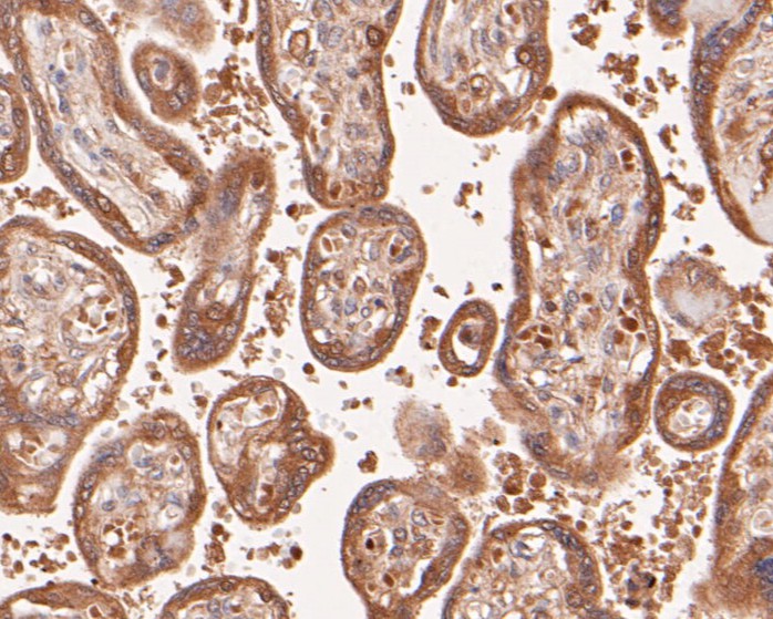 Immunohistochemical analysis of paraffin-embedded human placenta tissue using anti-DFNA5/GSDME antibody. The section was pre-treated using heat mediated antigen retrieval with Tris-EDTA buffer (pH 8.0-8.4) for 20 minutes.The tissues were blocked in 5% BSA for 30 minutes at room temperature, washed with ddH2O and PBS, and then probed with the primary antibody (EM1901-48, 1/50) for 30 minutes at room temperature. The detection was performed using an HRP conjugated compact polymer system. DAB was used as the chromogen. Tissues were counterstained with hematoxylin and mounted with DPX.