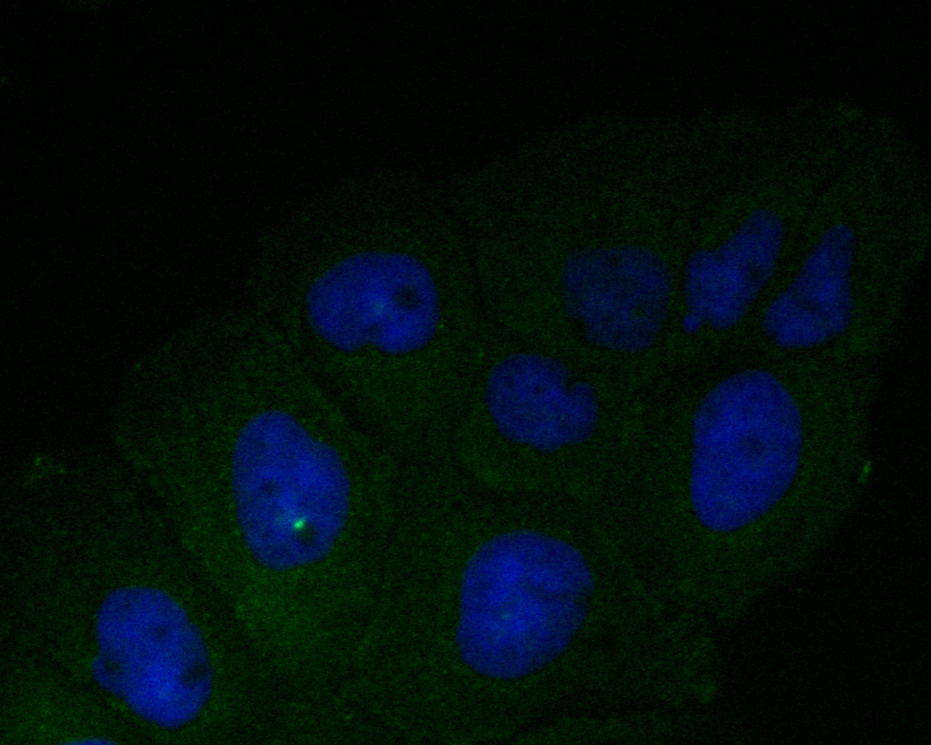 ICC staining of DFNA5/GSDME in A431 cells (green). Formalin fixed cells were permeabilized with 0.1% Triton X-100 in TBS for 10 minutes at room temperature and blocked with 1% Blocker BSA for 15 minutes at room temperature. Cells were probed with the primary antibody (EM1901-49, 1/50) for 1 hour at room temperature, washed with PBS. Alexa Fluor®488 Goat anti-Mouse IgG was used as the secondary antibody at 1/1,000 dilution. The nuclear counter stain is DAPI (blue).