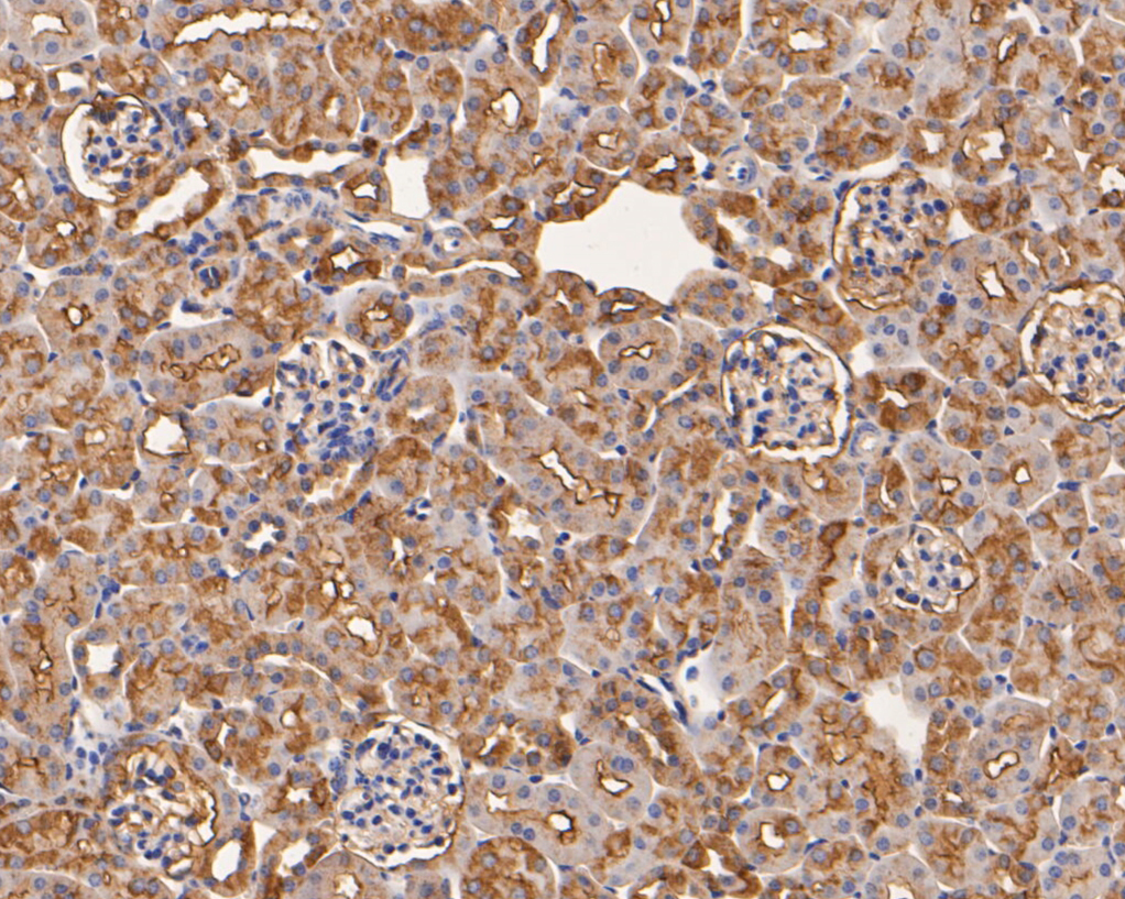 Immunohistochemical analysis of paraffin-embedded mouse kidney tissue using anti-Aspartate Aminotransferase antibody. The section was pre-treated using heat mediated antigen retrieval with Tris-EDTA buffer (pH 8.0-8.4) for 20 minutes.The tissues were blocked in 5% BSA for 30 minutes at room temperature, washed with ddH2O and PBS, and then probed with the primary antibody (EM1901-50, 1/50) for 30 minutes at room temperature. The detection was performed using an HRP conjugated compact polymer system. DAB was used as the chromogen. Tissues were counterstained with hematoxylin and mounted with DPX.