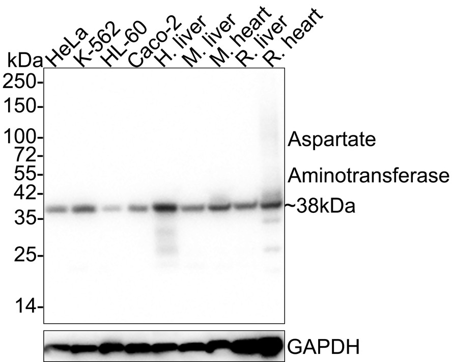 Western blot analysis of Aspartate Aminotransferase on different lysates. Proteins were transferred to a PVDF membrane and blocked with 5% BSA in PBS for 1 hour at room temperature. The primary antibody (EM1901-51, 1/500) was used in 5% BSA at room temperature for 2 hours. Goat Anti-Mouse IgG - HRP Secondary Antibody (HA1006) at 1:5,000 dilution was used for 1 hour at room temperature.<br />
Positive control: <br />
Lane 1: HepG2 cell lysate<br />
Lane 2: K562 cell lysate