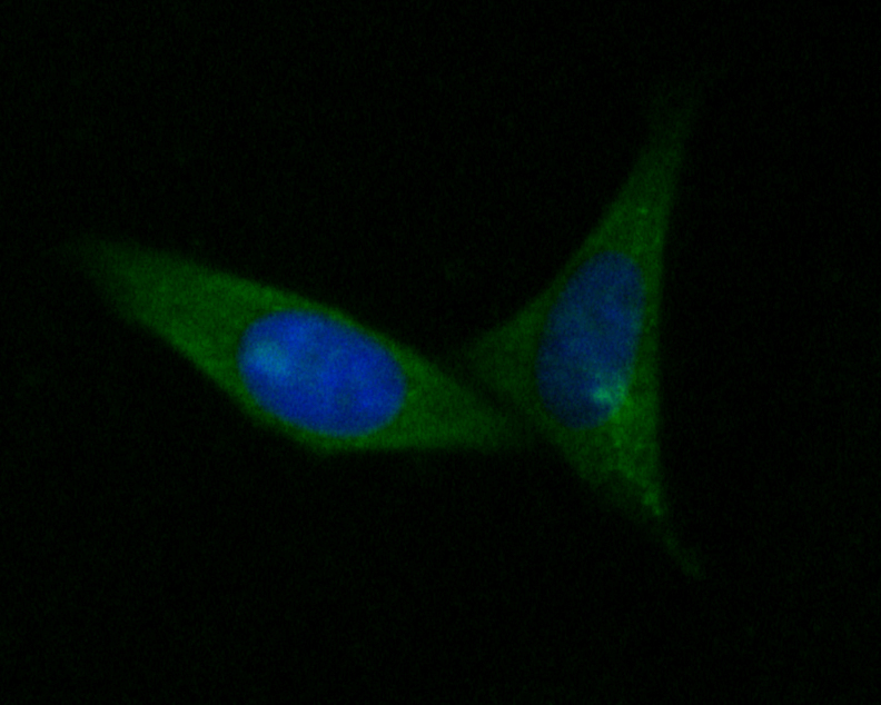 ICC staining of Aspartate Aminotransferase in SiHa cells (green). Formalin fixed cells were permeabilized with 0.1% Triton X-100 in TBS for 10 minutes at room temperature and blocked with 1% Blocker BSA for 15 minutes at room temperature. Cells were probed with the primary antibody (EM1901-51, 1/100) for 1 hour at room temperature, washed with PBS. Alexa Fluor®488 Goat anti-Mouse IgG was used as the secondary antibody at 1/1,000 dilution. The nuclear counter stain is DAPI (blue).