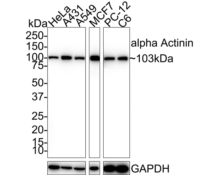 Western blot analysis of alpha Actinin on different lysates with Mouse anti-alpha Actinin antibody (EM1901-52) at 1/1,000 dilution.<br />
<br />
Lane 1: HeLa cell lysate<br />
Lane 2: A431 cell lysate<br />
Lane 3: A549 cell lysate<br />
Lane 4: MCF7 cell lysate<br />
Lane 5: PC-12 cell lysate<br />
Lane 6: C6 cell lysate<br />
<br />
Lysates/proteins at 20 µg/Lane.<br />
<br />
Predicted band size: 103 kDa<br />
Observed band size: 103 kDa<br />
<br />
Exposure time: 1 minute;<br />
<br />
4-20% SDS-PAGE gel.<br />
<br />
Proteins were transferred to a PVDF membrane and blocked with 5% NFDM/TBST for 1 hour at room temperature. The primary antibody (EM1901-52) at 1/1,000 dilution was used in 5% NFDM/TBST at 4℃ overnight. Goat Anti-Mouse IgG - HRP Secondary Antibody (HA1006) at 1/50,000 dilution was used for 1 hour at room temperature.
