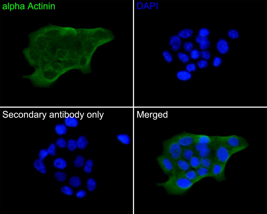 Immunocytochemistry analysis of A431 cells labeling alpha Actinin with Mouse anti-alpha Actinin antibody (EM1901-52) at 1/50 dilution.<br />
<br />
Cells were fixed in 4% paraformaldehyde for 30 minutes, permeabilized with 0.1% Triton X-100 in PBS for 15 minutes, and then blocked with 2% BSA for 30 minutes at room temperature. Cells were then incubated with Mouse anti-alpha Actinin antibody (EM1901-52) at 1/50 dilution in 2% BSA overnight at 4 ℃. Goat Anti-Mouse IgG H&L (iFluor™ 488, HA1125) was used as the secondary antibody at 1/1,000 dilution. PBS instead of the primary antibody was used as the secondary antibody only control. Nuclear DNA was labelled in blue with DAPI.