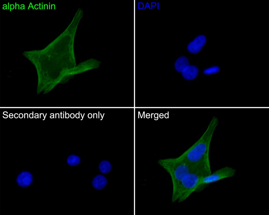 Immunocytochemistry analysis of SiHa cells labeling alpha Actinin with Mouse anti-alpha Actinin antibody (EM1901-52) at 1/50 dilution.<br />
<br />
Cells were fixed in 4% paraformaldehyde for 30 minutes, permeabilized with 0.1% Triton X-100 in PBS for 15 minutes, and then blocked with 2% BSA for 30 minutes at room temperature. Cells were then incubated with Mouse anti-alpha Actinin antibody (EM1901-52) at 1/50 dilution in 2% BSA overnight at 4 ℃. Goat Anti-Mouse IgG H&L (iFluor™ 488, HA1125) was used as the secondary antibody at 1/1,000 dilution. PBS instead of the primary antibody was used as the secondary antibody only control. Nuclear DNA was labelled in blue with DAPI.