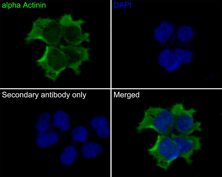 Immunocytochemistry analysis of JAR cells labeling alpha Actinin with Mouse anti-alpha Actinin antibody (EM1901-52) at 1/50 dilution.<br />
<br />
Cells were fixed in 4% paraformaldehyde for 30 minutes, permeabilized with 0.1% Triton X-100 in PBS for 15 minutes, and then blocked with 2% BSA for 30 minutes at room temperature. Cells were then incubated with Mouse anti-alpha Actinin antibody (EM1901-52) at 1/50 dilution in 2% BSA overnight at 4 ℃. Goat Anti-Mouse IgG H&L (iFluor™ 488, HA1125) was used as the secondary antibody at 1/1,000 dilution. PBS instead of the primary antibody was used as the secondary antibody only control. Nuclear DNA was labelled in blue with DAPI.