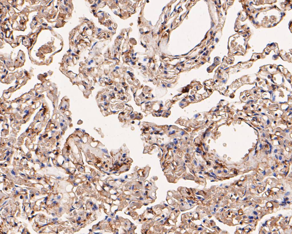 Immunohistochemical analysis of paraffin-embedded human lung tissue using anti-alpha Actinin antibody. The section was pre-treated using heat mediated antigen retrieval with Tris-EDTA buffer (pH 8.0-8.4) for 20 minutes.The tissues were blocked in 5% BSA for 30 minutes at room temperature, washed with ddH2O and PBS, and then probed with the primary antibody (EM1901-52, 1/50) for 30 minutes at room temperature. The detection was performed using an HRP conjugated compact polymer system. DAB was used as the chromogen. Tissues were counterstained with hematoxylin and mounted with DPX.
