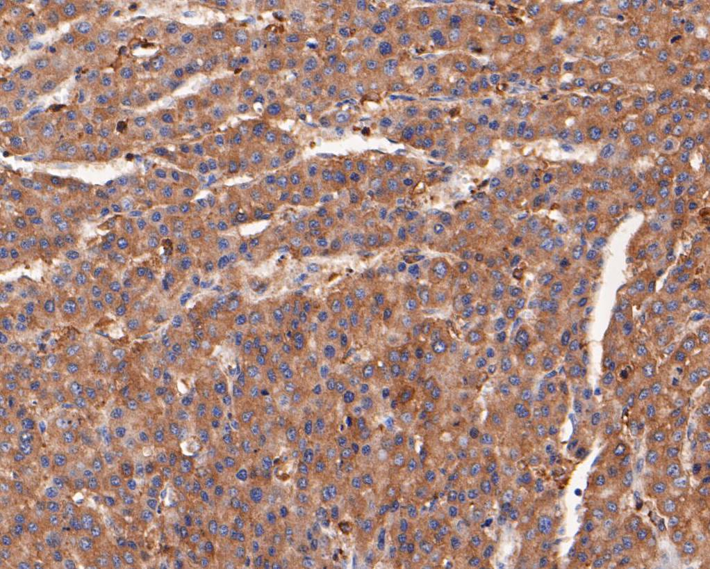 Immunohistochemical analysis of paraffin-embedded human skin tissue using anti-alpha Actinin antibody. The section was pre-treated using heat mediated antigen retrieval with Tris-EDTA buffer (pH 8.0-8.4) for 20 minutes.The tissues were blocked in 5% BSA for 30 minutes at room temperature, washed with ddH2O and PBS, and then probed with the primary antibody (EM1901-52, 1/50) for 30 minutes at room temperature. The detection was performed using an HRP conjugated compact polymer system. DAB was used as the chromogen. Tissues were counterstained with hematoxylin and mounted with DPX.