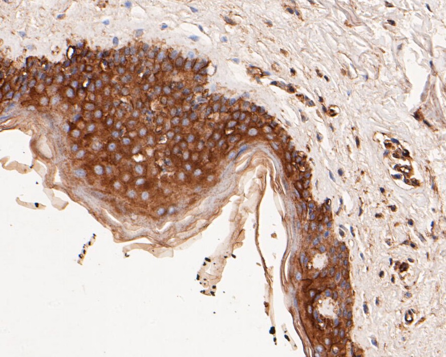 Immunohistochemical analysis of paraffin-embedded human breast tissue using anti-alpha Actinin antibody. The section was pre-treated using heat mediated antigen retrieval with Tris-EDTA buffer (pH 8.0-8.4) for 20 minutes.The tissues were blocked in 5% BSA for 30 minutes at room temperature, washed with ddH2O and PBS, and then probed with the primary antibody (EM1901-52, 1/50) for 30 minutes at room temperature. The detection was performed using an HRP conjugated compact polymer system. DAB was used as the chromogen. Tissues were counterstained with hematoxylin and mounted with DPX.