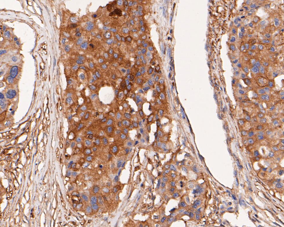 Immunohistochemical analysis of paraffin-embedded human kidney tissue using anti-alpha Actinin antibody. The section was pre-treated using heat mediated antigen retrieval with Tris-EDTA buffer (pH 8.0-8.4) for 20 minutes.The tissues were blocked in 5% BSA for 30 minutes at room temperature, washed with ddH2O and PBS, and then probed with the primary antibody (EM1901-52, 1/200) for 30 minutes at room temperature. The detection was performed using an HRP conjugated compact polymer system. DAB was used as the chromogen. Tissues were counterstained with hematoxylin and mounted with DPX.
