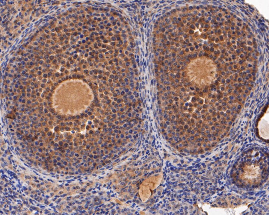 Immunohistochemical analysis of paraffin-embedded mouse ovary tissue using anti-ERK2 antibody. The section was pre-treated using heat mediated antigen retrieval with sodium citrate buffer (pH 6.0) for 20 minutes. The tissues were blocked in 5% BSA for 30 minutes at room temperature, washed with ddH2O and PBS, and then probed with the primary antibody (EM1901-53, 1/100)  for 30 minutes at room temperature. The detection was performed using an HRP conjugated compact polymer system. DAB was used as the chromogen. Tissues were counterstained with hematoxylin and mounted with DPX.
