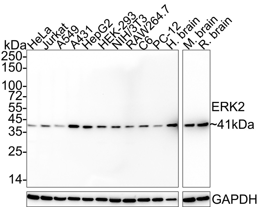 Western blot analysis of ERK2 on Hela cell lysates. Proteins were transferred to a PVDF membrane and blocked with 5% BSA in PBS for 1 hour at room temperature. The primary antibody (EM1901-54, 1/500) was used in 5% BSA at room temperature for 2 hours. Goat Anti-Mouse IgG - HRP Secondary Antibody (HA1006) at 1:5,000 dilution was used for 1 hour at room temperature.