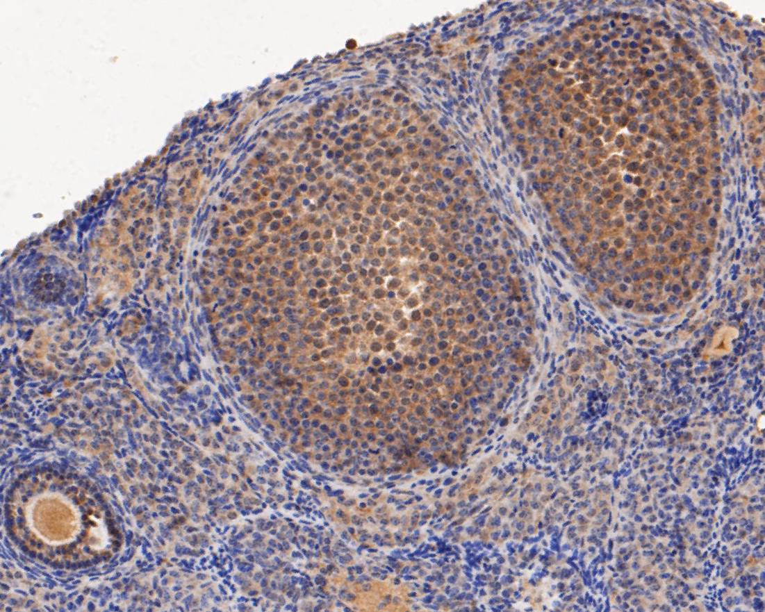 Immunohistochemical analysis of paraffin-embedded mouse ovary tissue using anti-ERK2 antibody. The section was pre-treated using heat mediated antigen retrieval with sodium citrate buffer (pH 6.0) for 20 minutes. The tissues were blocked in 5% BSA for 30 minutes at room temperature, washed with ddH2O and PBS, and then probed with the primary antibody (EM1901-54, 1/100)  for 30 minutes at room temperature. The detection was performed using an HRP conjugated compact polymer system. DAB was used as the chromogen. Tissues were counterstained with hematoxylin and mounted with DPX.