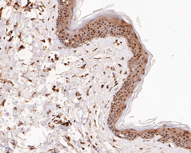 Immunohistochemical analysis of paraffin-embedded human skin tissue using anti-ERK2 antibody. The section was pre-treated using heat mediated antigen retrieval with sodium citrate buffer (pH 6.0) for 20 minutes. The tissues were blocked in 5% BSA for 30 minutes at room temperature, washed with ddH2O and PBS, and then probed with the primary antibody (EM1901-55, 1/100)  for 30 minutes at room temperature. The detection was performed using an HRP conjugated compact polymer system. DAB was used as the chromogen. Tissues were counterstained with hematoxylin and mounted with DPX.