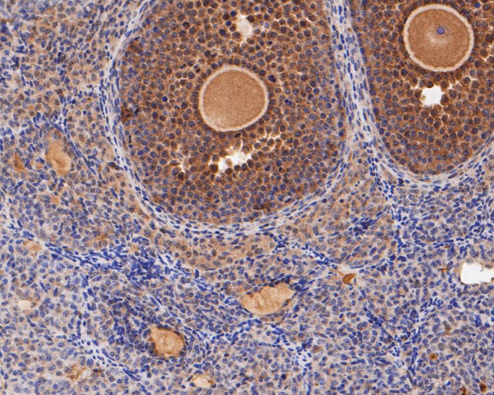 Immunohistochemical analysis of paraffin-embedded mouse ovary tissue using anti-ERK2 antibody. The section was pre-treated using heat mediated antigen retrieval with sodium citrate buffer (pH 6.0) for 20 minutes. The tissues were blocked in 5% BSA for 30 minutes at room temperature, washed with ddH2O and PBS, and then probed with the primary antibody (EM1901-55, 1/100)  for 30 minutes at room temperature. The detection was performed using an HRP conjugated compact polymer system. DAB was used as the chromogen. Tissues were counterstained with hematoxylin and mounted with DPX.