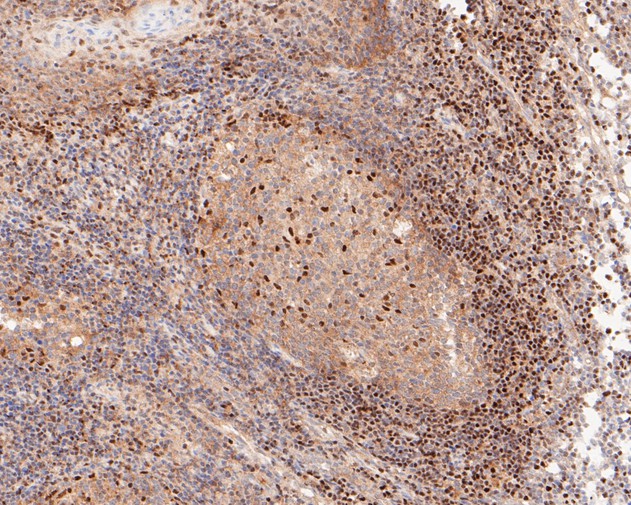 Immunohistochemical analysis of paraffin-embedded human tonsil tissue using anti-GAPDH antibody. The section was pre-treated using heat mediated antigen retrieval with sodium citrate buffer (pH 6.0) for 20 minutes. The tissues were blocked in 5% BSA for 30 minutes at room temperature, washed with ddH2O and PBS, and then probed with the primary antibody (EM1901-57, 1/50)  for 30 minutes at room temperature. The detection was performed using an HRP conjugated compact polymer system. DAB was used as the chromogen. Tissues were counterstained with hematoxylin and mounted with DPX.