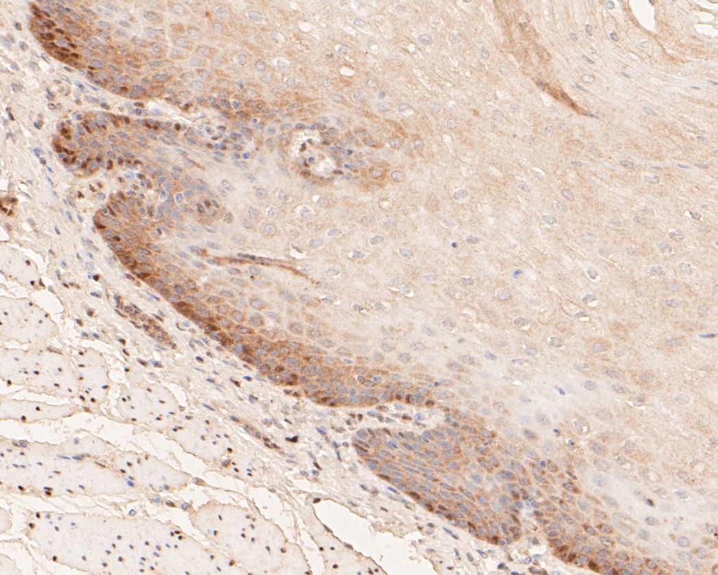 Immunohistochemical analysis of paraffin-embedded human esophagus tissue using anti-GAPDH antibody. The section was pre-treated using heat mediated antigen retrieval with sodium citrate buffer (pH 6.0) for 20 minutes. The tissues were blocked in 5% BSA for 30 minutes at room temperature, washed with ddH2O and PBS, and then probed with the primary antibody (EM1901-57, 1/50)  for 30 minutes at room temperature. The detection was performed using an HRP conjugated compact polymer system. DAB was used as the chromogen. Tissues were counterstained with hematoxylin and mounted with DPX.