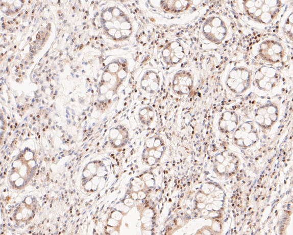 Immunohistochemical analysis of paraffin-embedded human small intestine tissue using anti-GAPDH antibody. The section was pre-treated using heat mediated antigen retrieval with sodium citrate buffer (pH 6.0) for 20 minutes. The tissues were blocked in 5% BSA for 30 minutes at room temperature, washed with ddH2O and PBS, and then probed with the primary antibody (EM1901-57, 1/50)  for 30 minutes at room temperature. The detection was performed using an HRP conjugated compact polymer system. DAB was used as the chromogen. Tissues were counterstained with hematoxylin and mounted with DPX.