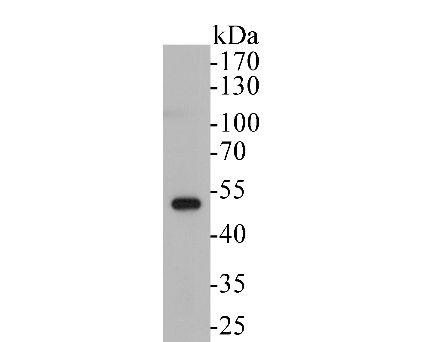 Western blot analysis of RUVB2 on A549 cell lysates. Proteins were transferred to a PVDF membrane and blocked with 5% BSA in PBS for 1 hour at room temperature. The primary antibody (EM1901-59, 1/500) was used in 5% BSA at room temperature for 2 hours. Goat Anti-Mouse IgG - HRP Secondary Antibody (HA1006) at 1:5,000 dilution was used for 1 hour at room temperature.