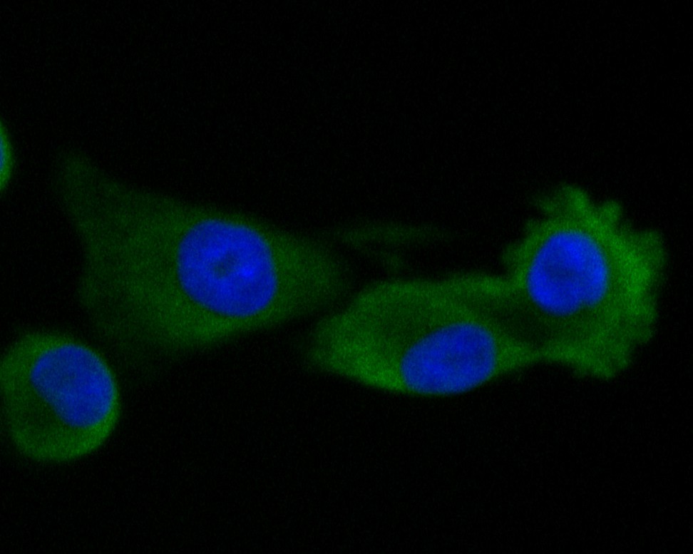 ICC staining of RUVB2 in A549 cells (green). Formalin fixed cells were permeabilized with 0.1% Triton X-100 in TBS for 10 minutes at room temperature and blocked with 1% Blocker BSA for 15 minutes at room temperature. Cells were probed with the primary antibody (EM1901-59, 1/50) for 1 hour at room temperature, washed with PBS. Alexa Fluor®488 Goat anti-Mouse IgG was used as the secondary antibody at 1/1,000 dilution. The nuclear counter stain is DAPI (blue).
