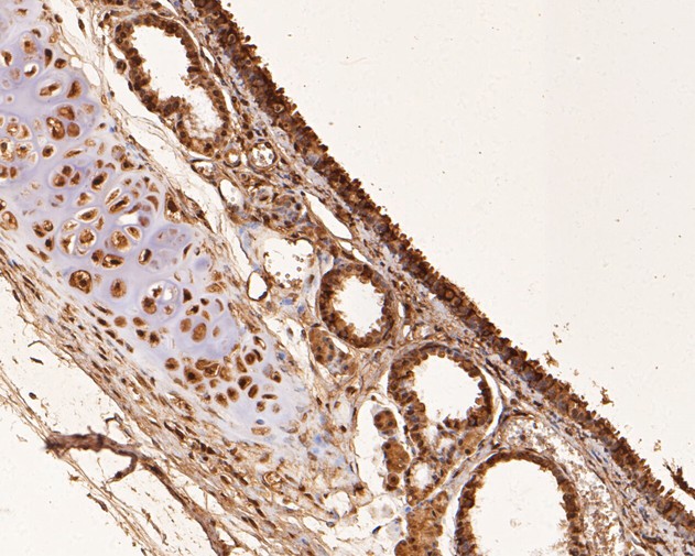 Immunohistochemical analysis of paraffin-embedded rat trachea tissue tissue using anti-RUVB2 antibody. The section was pre-treated using heat mediated antigen retrieval with sodium citrate buffer (pH 6.0) for 20 minutes. The tissues were blocked in 5% BSA for 30 minutes at room temperature, washed with ddH2O and PBS, and then probed with the primary antibody (EM1901-59, 1/50)  for 30 minutes at room temperature. The detection was performed using an HRP conjugated compact polymer system. DAB was used as the chromogen. Tissues were counterstained with hematoxylin and mounted with DPX.