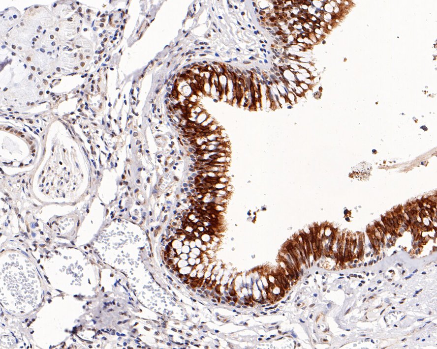 Immunohistochemical analysis of paraffin-embedded human trachea tissue with Mouse anti-RUVB2 antibody (EM1901-59) at 1/1,000 dilution.<br />
<br />
The section was pre-treated using heat mediated antigen retrieval with sodium citrate buffer (pH 6.0) for 2 minutes. The tissues were blocked in 1% BSA for 20 minutes at room temperature, washed with ddH2O and PBS, and then probed with the primary antibody (EM1901-59) at 1/1,000 dilution for 1 hour at room temperature. The detection was performed using an HRP conjugated compact polymer system. DAB was used as the chromogen. Tissues were counterstained with hematoxylin and mounted with DPX.
