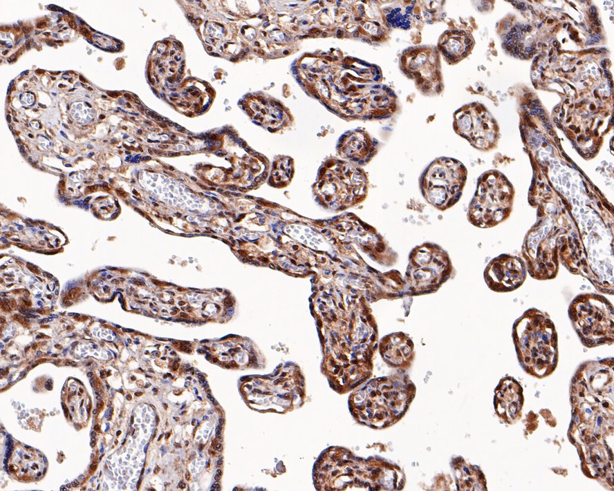 Immunohistochemical analysis of paraffin-embedded human colon tissue using anti-RUVB2 antibody. The section was pre-treated using heat mediated antigen retrieval with sodium citrate buffer (pH 6.0) for 20 minutes. The tissues were blocked in 5% BSA for 30 minutes at room temperature, washed with ddH2O and PBS, and then probed with the primary antibody (EM1901-59, 1/50)  for 30 minutes at room temperature. The detection was performed using an HRP conjugated compact polymer system. DAB was used as the chromogen. Tissues were counterstained with hematoxylin and mounted with DPX.