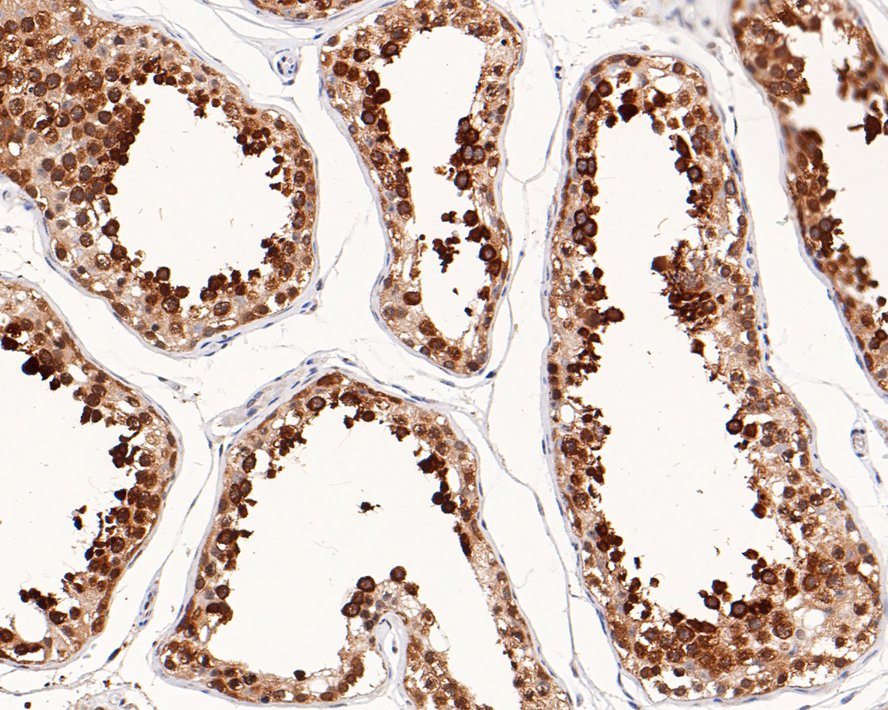 Immunohistochemical analysis of paraffin-embedded human testis tissue with Mouse anti-RUVB2 antibody (EM1901-59) at 1/1,000 dilution.<br />
<br />
The section was pre-treated using heat mediated antigen retrieval with sodium citrate buffer (pH 6.0) for 2 minutes. The tissues were blocked in 1% BSA for 20 minutes at room temperature, washed with ddH2O and PBS, and then probed with the primary antibody (EM1901-59) at 1/1,000 dilution for 1 hour at room temperature. The detection was performed using an HRP conjugated compact polymer system. DAB was used as the chromogen. Tissues were counterstained with hematoxylin and mounted with DPX.