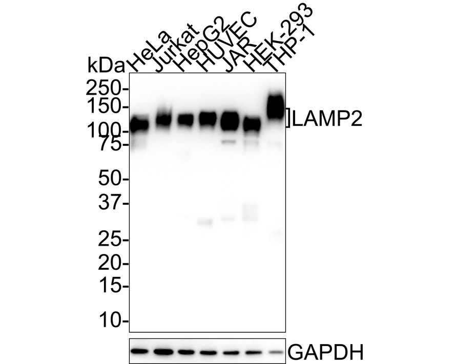 Western blot analysis of LAMP2 on SiHa cell lysates. Proteins were transferred to a PVDF membrane and blocked with 5% BSA in PBS for 1 hour at room temperature. The primary antibody (EM1901-62, 1/500) was used in 5% BSA at room temperature for 2 hours. Goat Anti-Mouse IgG - HRP Secondary Antibody (HA1006) at 1:5,000 dilution was used for 1 hour at room temperature.