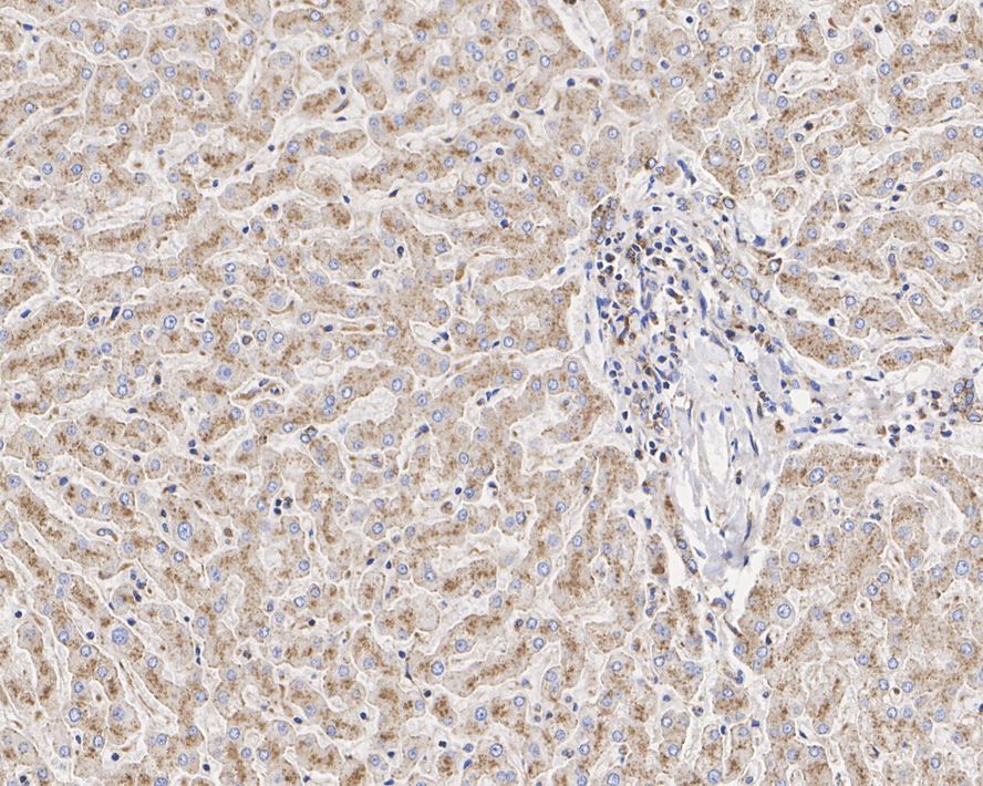 Immunohistochemical analysis of paraffin-embedded human prostate tissue using anti-LAMP2 antibody. The section was pre-treated using heat mediated antigen retrieval with Tris-EDTA buffer (pH 8.0-8.4) for 20 minutes.The tissues were blocked in 5% BSA for 30 minutes at room temperature, washed with ddH2O and PBS, and then probed with the primary antibody (EM1901-62, 1/50) for 30 minutes at room temperature. The detection was performed using an HRP conjugated compact polymer system. DAB was used as the chromogen. Tissues were counterstained with hematoxylin and mounted with DPX.