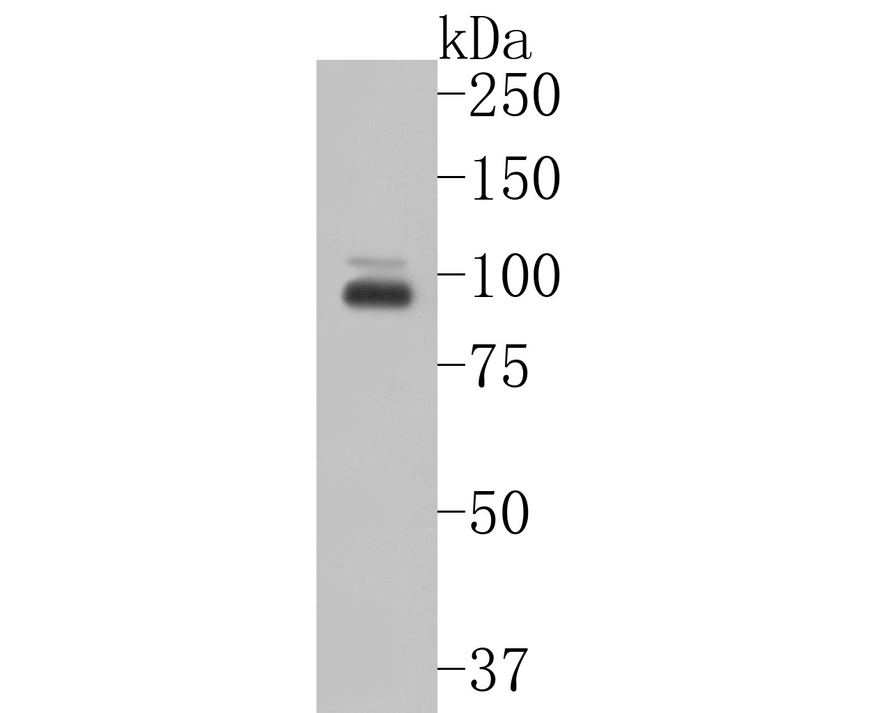 Western blot analysis of CLEC4F on SH-SY5Y cell lysates. Proteins were transferred to a PVDF membrane and blocked with 5% BSA in PBS for 1 hour at room temperature. The primary antibody (EM1901-63, 1/500) was used in 5% BSA at room temperature for 2 hours. Goat Anti-Mouse IgG - HRP Secondary Antibody (HA1006) at 1:5,000 dilution was used for 1 hour at room temperature.