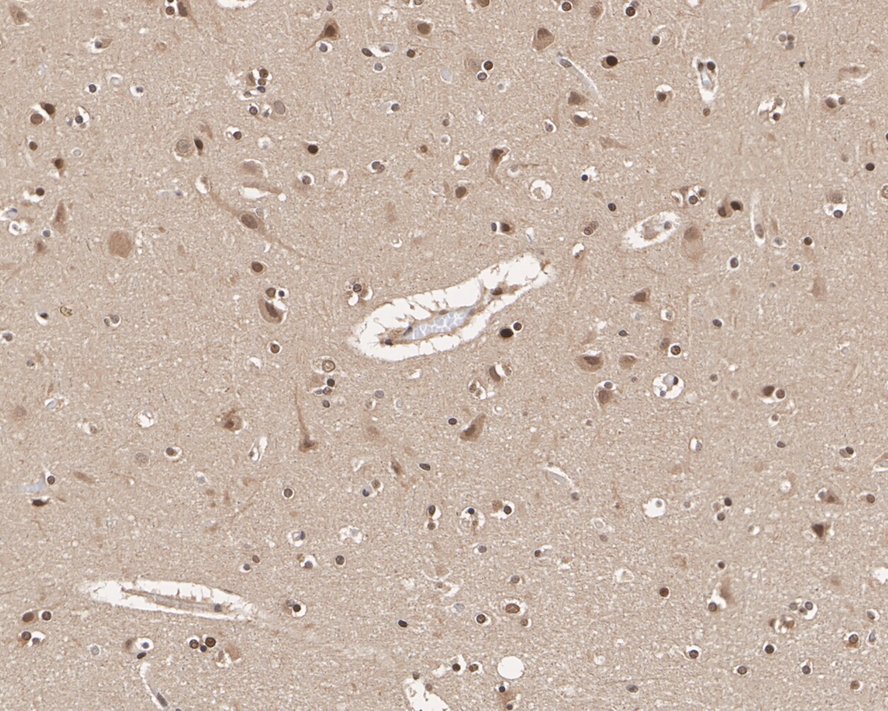 Immunohistochemical analysis of paraffin-embedded human lung tissue using anti-UBA3 antibody. The section was pre-treated using heat mediated antigen retrieval with sodium citrate buffer (pH 6.0) for 20 minutes. The tissues were blocked in 5% BSA for 30 minutes at room temperature, washed with ddH2O and PBS, and then probed with the primary antibody (EM1901-65, 1/400)  for 30 minutes at room temperature. The detection was performed using an HRP conjugated compact polymer system. DAB was used as the chromogen. Tissues were counterstained with hematoxylin and mounted with DPX.