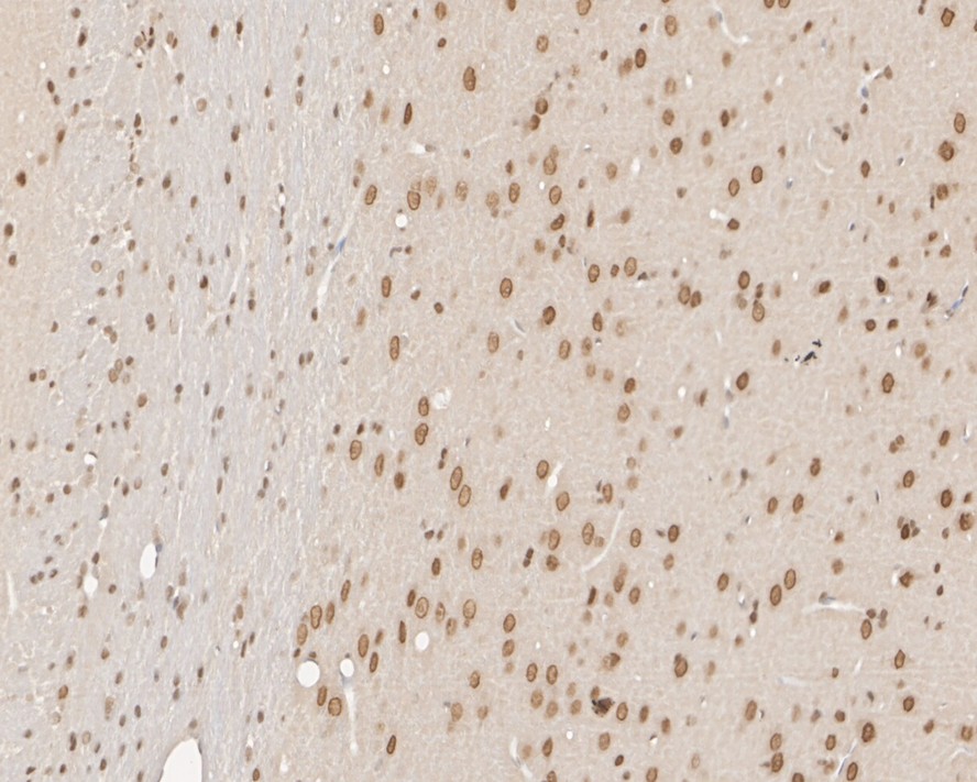 Immunohistochemical analysis of paraffin-embedded human skin tissue using anti-UBA3 antibody. The section was pre-treated using heat mediated antigen retrieval with sodium citrate buffer (pH 6.0) for 20 minutes. The tissues were blocked in 5% BSA for 30 minutes at room temperature, washed with ddH2O and PBS, and then probed with the primary antibody (EM1901-65, 1/400)  for 30 minutes at room temperature. The detection was performed using an HRP conjugated compact polymer system. DAB was used as the chromogen. Tissues were counterstained with hematoxylin and mounted with DPX.