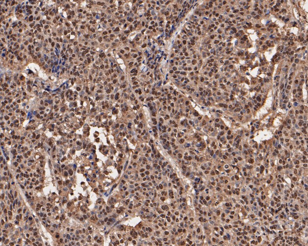Immunohistochemical analysis of paraffin-embedded human esophagus tissue using anti-UBA3 antibody. The section was pre-treated using heat mediated antigen retrieval with sodium citrate buffer (pH 6.0) for 20 minutes. The tissues were blocked in 5% BSA for 30 minutes at room temperature, washed with ddH2O and PBS, and then probed with the primary antibody (EM1901-65, 1/200)  for 30 minutes at room temperature. The detection was performed using an HRP conjugated compact polymer system. DAB was used as the chromogen. Tissues were counterstained with hematoxylin and mounted with DPX.