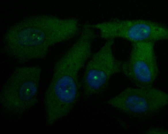 ICC staining of UBA3 in EA.hy926 cells (green). Formalin fixed cells were permeabilized with 0.1% Triton X-100 in TBS for 10 minutes at room temperature and blocked with 1% Blocker BSA for 15 minutes at room temperature. Cells were probed with the primary antibody (EM1901-66, 1/50) for 1 hour at room temperature, washed with PBS. Alexa Fluor®488 Goat anti-Mouse IgG was used as the secondary antibody at 1/1,000 dilution. The nuclear counter stain is DAPI (blue).