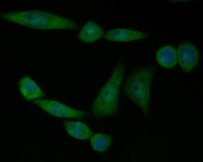 ICC staining of UBA3 in SiHa cells (green). Formalin fixed cells were permeabilized with 0.1% Triton X-100 in TBS for 10 minutes at room temperature and blocked with 1% Blocker BSA for 15 minutes at room temperature. Cells were probed with the primary antibody (EM1901-66, 1/50) for 1 hour at room temperature, washed with PBS. Alexa Fluor®488 Goat anti-Mouse IgG was used as the secondary antibody at 1/1,000 dilution. The nuclear counter stain is DAPI (blue).