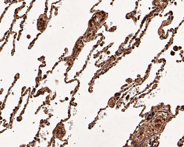Immunohistochemical analysis of paraffin-embedded human lung tissue using anti-UBA3 antibody. The section was pre-treated using heat mediated antigen retrieval with sodium citrate buffer (pH 6.0) for 20 minutes. The tissues were blocked in 5% BSA for 30 minutes at room temperature, washed with ddH2O and PBS, and then probed with the primary antibody (EM1901-66, 1/200)  for 30 minutes at room temperature. The detection was performed using an HRP conjugated compact polymer system. DAB was used as the chromogen. Tissues were counterstained with hematoxylin and mounted with DPX.