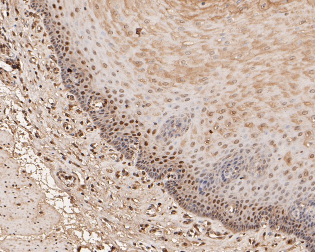 Immunohistochemical analysis of paraffin-embedded human esophagus tissue using anti-UBA3 antibody. The section was pre-treated using heat mediated antigen retrieval with sodium citrate buffer (pH 6.0) for 20 minutes. The tissues were blocked in 5% BSA for 30 minutes at room temperature, washed with ddH2O and PBS, and then probed with the primary antibody (EM1901-66, 1/200)  for 30 minutes at room temperature. The detection was performed using an HRP conjugated compact polymer system. DAB was used as the chromogen. Tissues were counterstained with hematoxylin and mounted with DPX.