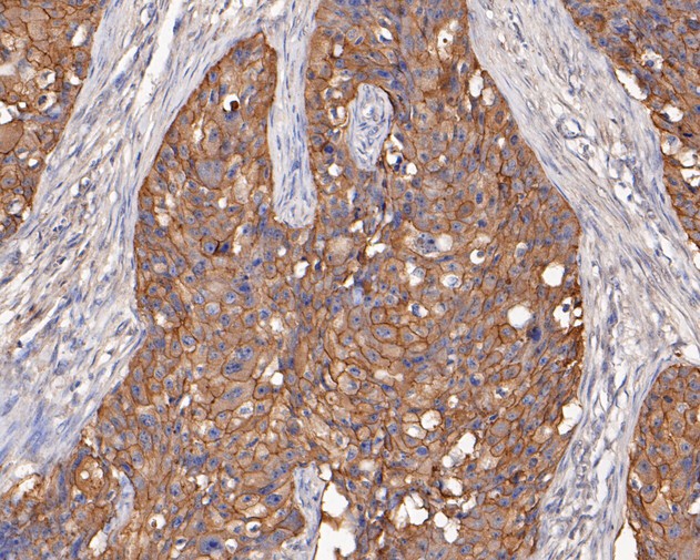 ICC staining of EGFR in A549 cells (green). Formalin fixed cells were permeabilized with 0.1% Triton X-100 in TBS for 10 minutes at room temperature and blocked with 1% Blocker BSA for 15 minutes at room temperature. Cells were probed with the primary antibody (EM1901-67, 1/50) for 1 hour at room temperature, washed with PBS. Alexa Fluor®488 Goat anti-Mouse IgG was used as the secondary antibody at 1/1,000 dilution. The nuclear counter stain is DAPI (blue).