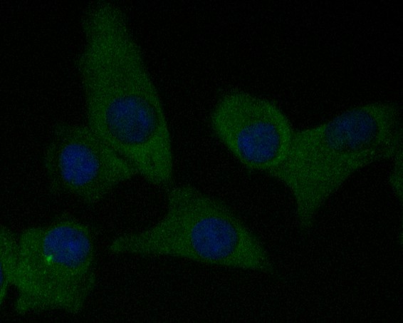 ICC staining of CEACAM6 in A549 cells (green). Formalin fixed cells were permeabilized with 0.1% Triton X-100 in TBS for 10 minutes at room temperature and blocked with 1% Blocker BSA for 15 minutes at room temperature. Cells were probed with the primary antibody (EM1901-68, 1/50) for 1 hour at room temperature, washed with PBS. Alexa Fluor®488 Goat anti-Mouse IgG was used as the secondary antibody at 1/1,000 dilution. The nuclear counter stain is DAPI (blue).