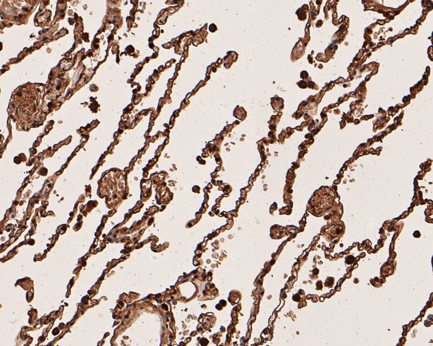 Immunohistochemical analysis of paraffin-embedded human lung tissue using anti-CEACAM6 antibody. The section was pre-treated using heat mediated antigen retrieval with Tris-EDTA buffer (pH 8.0-8.4) for 20 minutes.The tissues were blocked in 5% BSA for 30 minutes at room temperature, washed with ddH2O and PBS, and then probed with the primary antibody (EM1901-69, 1/400) for 30 minutes at room temperature. The detection was performed using an HRP conjugated compact polymer system. DAB was used as the chromogen. Tissues were counterstained with hematoxylin and mounted with DPX.