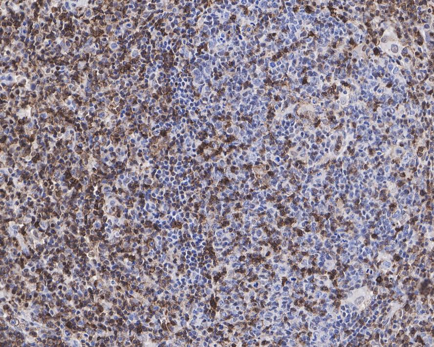 Immunohistochemical analysis of paraffin-embedded human tonsil tissue using anti-CD43 antibody. The section was pre-treated using heat mediated antigen retrieval with sodium citrate buffer (pH 6.0) for 20 minutes. The tissues were blocked in 5% BSA for 30 minutes at room temperature, washed with ddH2O and PBS, and then probed with the primary antibody (EM1901-70, 1/200)  for 30 minutes at room temperature. The detection was performed using an HRP conjugated compact polymer system. DAB was used as the chromogen. Tissues were counterstained with hematoxylin and mounted with DPX.