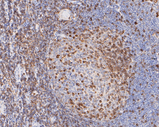 Immunohistochemical analysis of paraffin-embedded human tonsil tissue using anti-CD43 antibody. The section was pre-treated using heat mediated antigen retrieval with sodium citrate buffer (pH 6.0) for 20 minutes. The tissues were blocked in 5% BSA for 30 minutes at room temperature, washed with ddH2O and PBS, and then probed with the primary antibody (EM1901-71, 1/200)  for 30 minutes at room temperature. The detection was performed using an HRP conjugated compact polymer system. DAB was used as the chromogen. Tissues were counterstained with hematoxylin and mounted with DPX.