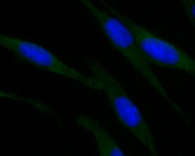 ICC staining of ROBO1 in SHSY5Y cells (green). Formalin fixed cells were permeabilized with 0.1% Triton X-100 in TBS for 10 minutes at room temperature and blocked with 1% Blocker BSA for 15 minutes at room temperature. Cells were probed with the primary antibody (EM1901-72, 1/100) for 1 hour at room temperature, washed with PBS. Alexa FluorTM488 Goat anti-Mouse IgG was used as the secondary antibody at 1/100 dilution. The nuclear counter stain is DAPI (blue).