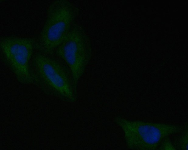 ICC staining of ROBO1 in Siha cells (green). Formalin fixed cells were permeabilized with 0.1% Triton X-100 in TBS for 10 minutes at room temperature and blocked with 1% Blocker BSA for 15 minutes at room temperature. Cells were probed with the primary antibody (EM1901-72, 1/100) for 1 hour at room temperature, washed with PBS. Alexa FluorTM488 Goat anti-Mouse  IgG was used as the secondary antibody at 1/100 dilution. The nuclear counter stain is DAPI (blue).