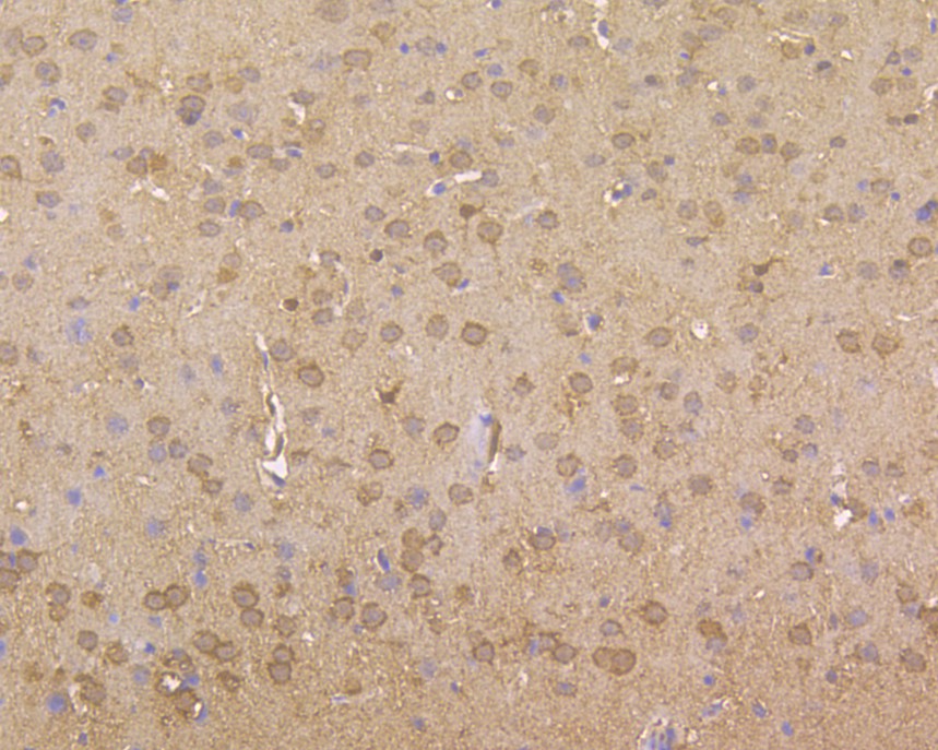 Immunohistochemical analysis of paraffin-embedded mouse brain tissue using anti-ROBO1 antibody. The section was pre-treated using heat mediated antigen retrieval with Tris-EDTA buffer (pH 8.0-8.4) for 20 minutes.The tissues were blocked in 5% BSA for 30 minutes at room temperature, washed with ddH2O and PBS, and then probed with the primary antibody (EM1901-72, 1/100) for 30 minutes at room temperature. The detection was performed using an HRP conjugated compact polymer system. DAB was used as the chromogen. Tissues were counterstained with hematoxylin and mounted with DPX.